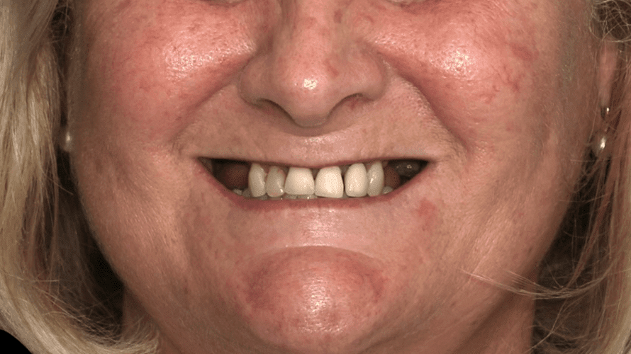 photo 11-aabefore (1)