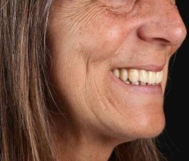 photo-33-After-e1710153407723 (4)