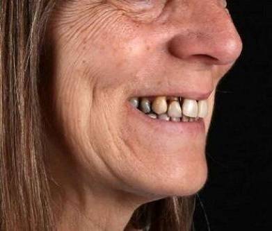 photo-33-Before-1-e1710153169417 (2)